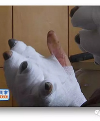 ���£�����һ����ϴ���� ��ָ����Ƥ������ 5����ָҪ�ص�