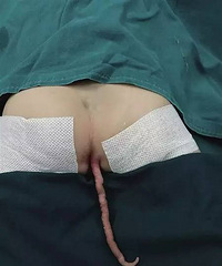 ����ƨ�ɺ��и���β�� ԭ�������軳��ʱ...