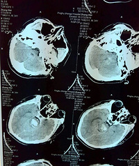 [����]���Ż���7���� �Ϲ�ȴͻ�����Ըɳ�Ѫ��Ȼ���