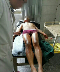 ��ù��һ�������������ʱú��ͻȻ��ը�������ر���ҽԺ����