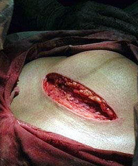 ��̥�����ڼҲ��Ӵ��Ѫ ����û��ס ����ȴ˵��������