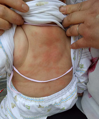 ������Ļ�����ʪ��Ȼȫ������ С����Ҳ������