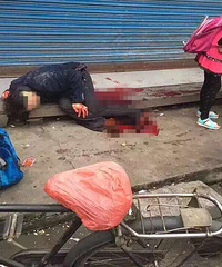 һ������Ʒ���Ѫ������˵������Ͳ˷���Ϊ��ͨ�¹�������Ѫ����