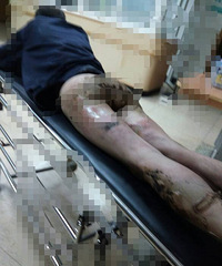 �Ҳ��̶ã�����һ����ƨ�ɱ��̽��� Ƥ���⶧��