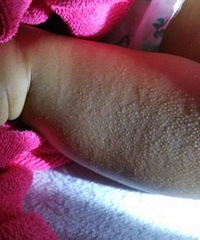 �������̷�ι��2���� ���ϳ��˼�Ƥ���� ��С����Ҳ������