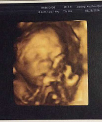 ���������� 123�š����� ���� ����