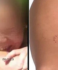 Ů�ӿ���ƿ��Υ�汻�� ŭҧ���������