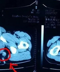 𾪣һӰԼջߵֱͱˡ