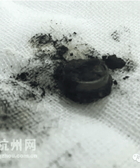 5�걦������Ũ�Ʊ��飬������ζ��ȥҽԺһ�龪����..