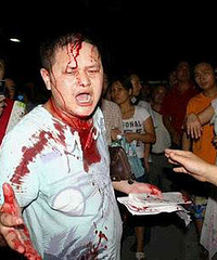 Ůͬѧ���Ÿ� ���ѳưְ��Ǵ󷨹������Ǻڰ��ϴ�