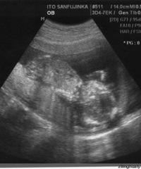 6������άB������������ֻ��һ������...