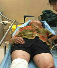 �ң����̵��½γ�ײ����ƿ�� Ů�ӱ�����ʮ����