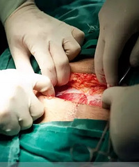 "100张剖腹产过程照片,女人真的太伟大了!"