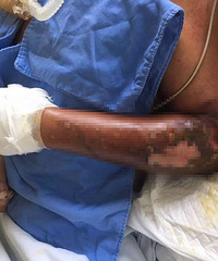 ����ӽ�70�ȣ����Ȼ���ˮ��·��20����  �̽�һ��Ƭ