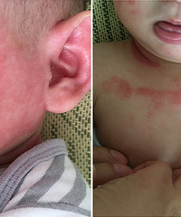 3���±���ȫ������� Ƥ���ֲ� ������