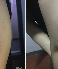 ���ߣ�������ס��һ��  �����������ϰ嶾��