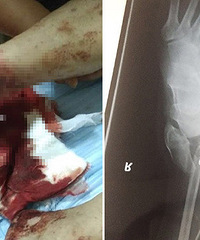 ���أ�С���ϰ�������������ִ  �����˴��������