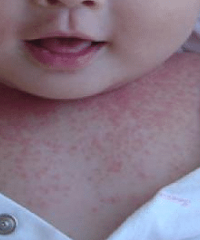 2����ͯ���ղ�ֹ ���û�� ԭ�������...