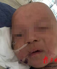 3�´���ͯ����ұ� ��Ű���߹ǹ��ۡ�­�ڳ�Ѫ��