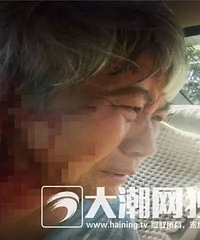 �ֲ�������һ������Ȯ���������� ��ҧ2�ˣ�