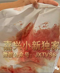 ���޳�����ԷѪ����������˾���õ�ͱ������ ����������ֻ��2cm