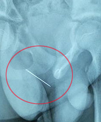 �к���������������� ȡ����ʱ�Ѿ�����