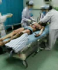 ����9�����ҵ·һ���˱�����¯������ɻ����� ȫ���Ҳ��̶�