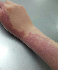 �ø��з��г� ȴ���ɫ̥�ǲ�����ĸ�����ԧ�죡