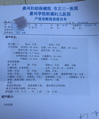 �����ơ���24����ά��� ̥����ΧƫС