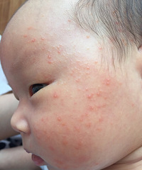 �����ơ����� ����ǲ���ʪ�