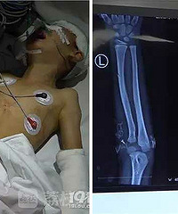 7����ͯ����ĸ����20�൶ ˫���ֱ۹���..