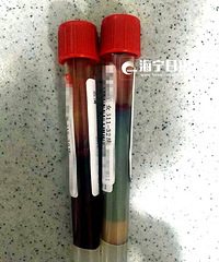 ����������32��Ů�ӳ�����Щ�����󣬳������Ѫ��Ȼ�����ɫ��