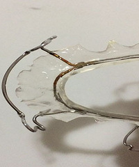 �ڼ���ĳҽԺ����  ���������