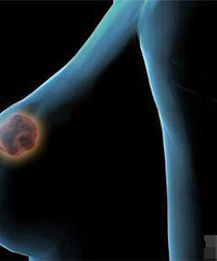 Ϊ�˲������Ӷ��� �����������顤��������鷿������