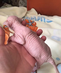 ��ȵı�������Ԥ����