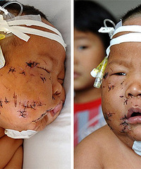 ��Ӥ����ʱҧʹ���� ��������ͱ�˽�90��