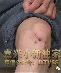 ���ӵķ���ծ�ǻ������˶��Ӵ����Ӵ����ع� ���������������