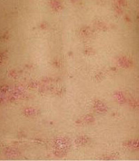 ���꣡����ţƤѢȫ�������ޱ� ��������ʧ��ͷ��...