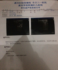 ����    �������ֲ���