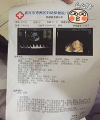 ȥ����ά ������������� �õ���Ƭһ������...