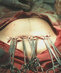 ���ʣ�һ̥�ʵ���������Ӱ  ��̥����˳�� ���Ƽ�ҽ��