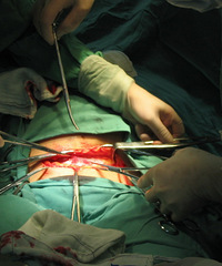 ����ͷ��˳������������ȥ�ʸ���  ����ӹ����Ѫ....