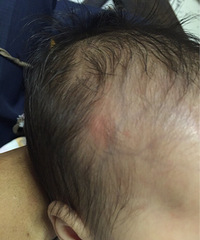 70��Ӥ��ͷ���п���