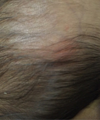 70��Ӥ��ͷ���п���