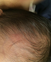 �����ˣ�70��Ӥ��ͷ���п��� ���ֲ�ֹ...