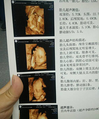 ���ʳ�¯����ά!�����ù� �������...