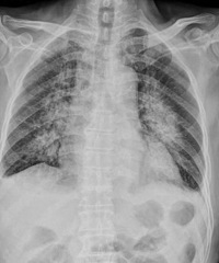 ����8��Ů����ˮ�ס���Ѫ��С��ʧ�� ԭ���Ǽ������������