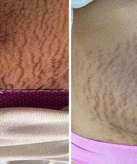 ��������40�� ������ӳ����⸱����