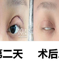 ���˸�˫��Ƥ �۾����ϲ�����