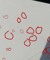 �ܼ��־�֢���ˣ��³���ȫ�ǽ����Ŀ��� �ͳ��Ӷ�ͬ����